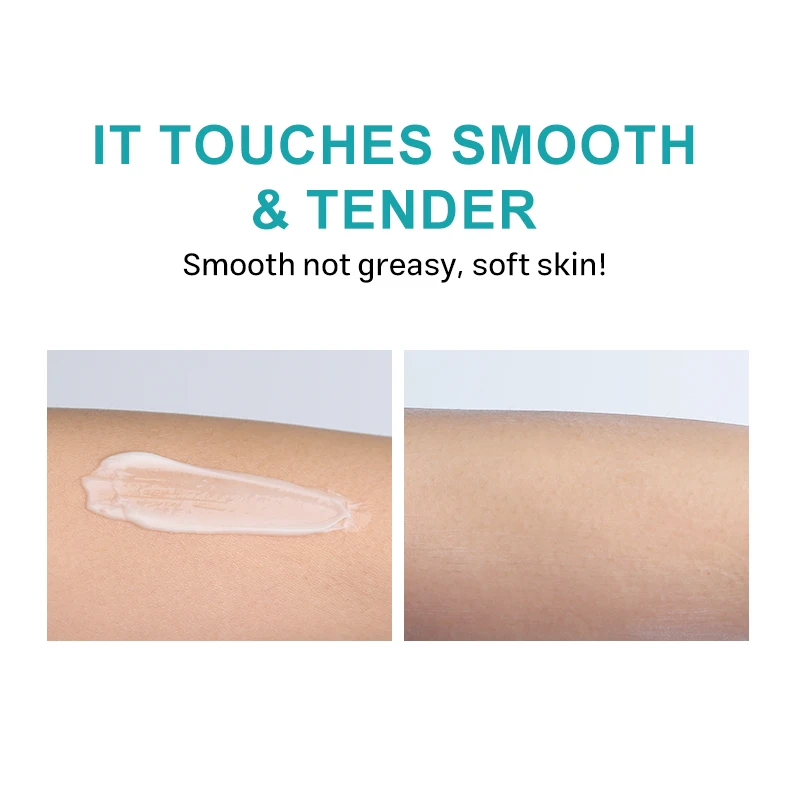 OEM Custom Logo Dark Spot Remover Facial Cream Pimples Acne Mark Dark Spots corrector Whitening Face Cream For Skincare Products