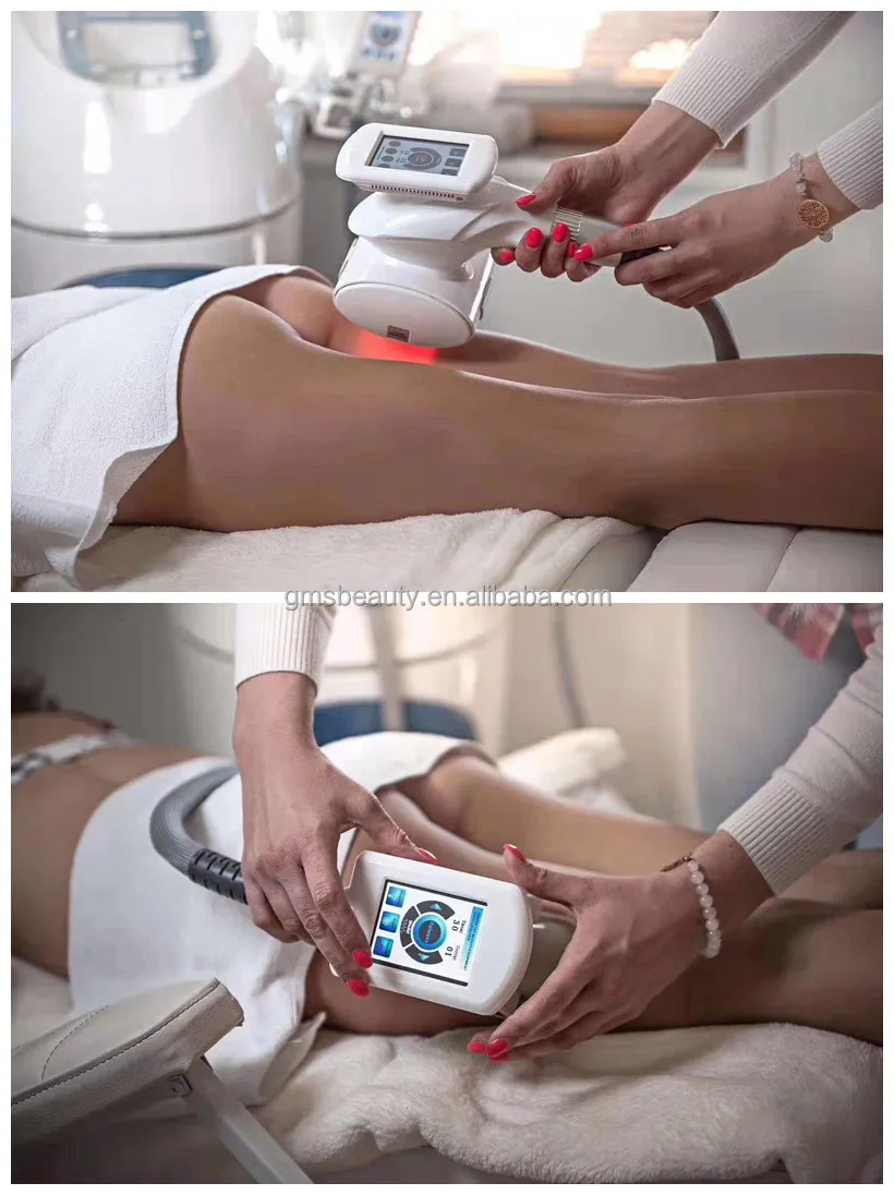 portable-v9-slimming-machine-cavitation-rf-vacuum-roller-bio-laser-slimming-cellulite-reduction-face-shaping-machine