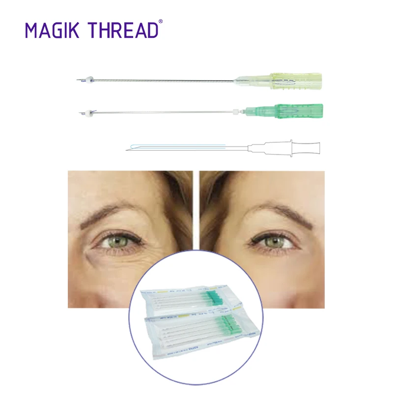 Резьба Magik mini mono с маркировкой CE 30 г * 25 мм Корейская резьба pdo eye lift для подъема