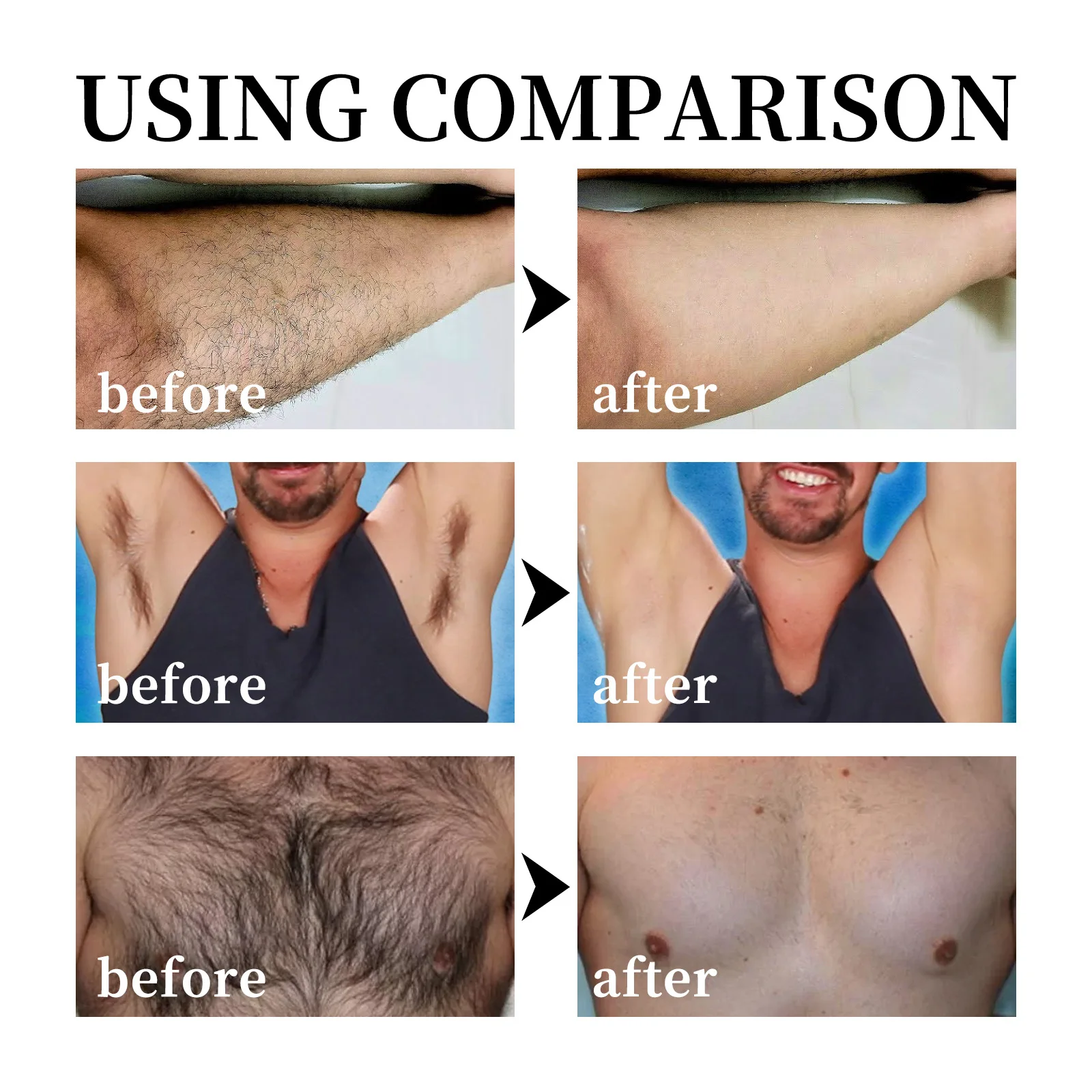 EAST MOON OEM ODM Best Seller Body Hair Removal for Men Private Area Shaving