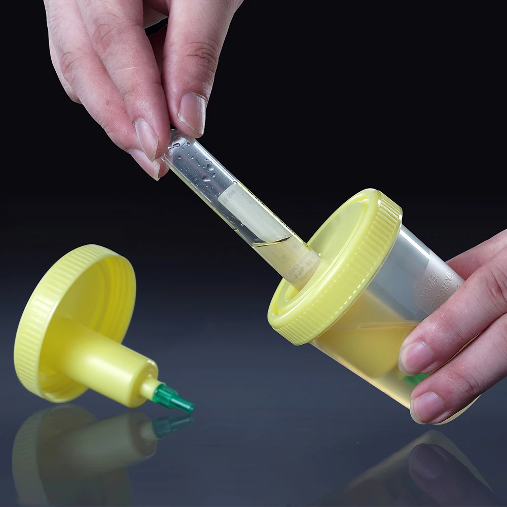 Медицинский образец, одноразовая Вакуумная чашка для сбора мочи 100 мл оптом