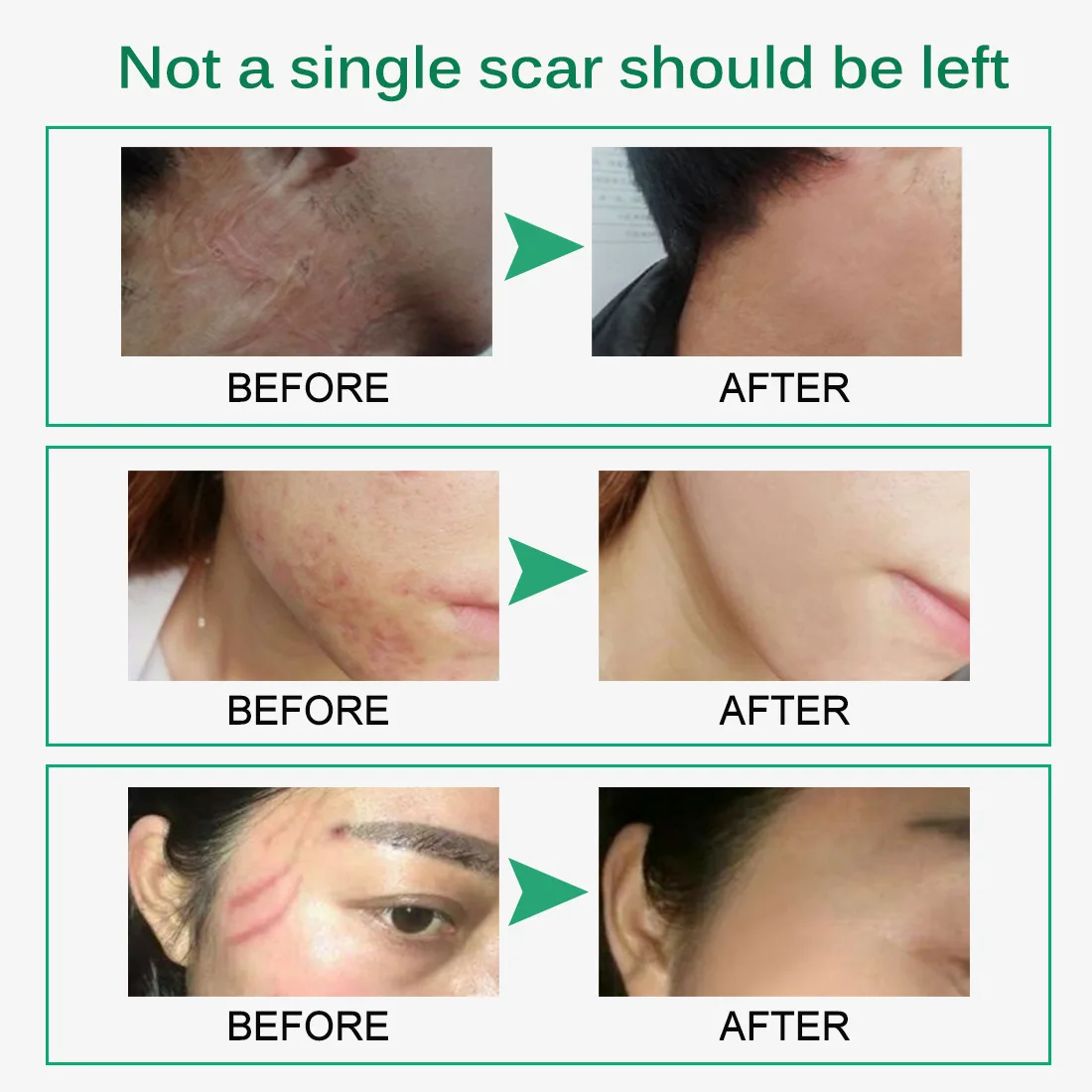 Repair anti-aging firming  antibiotic free remover scar cream