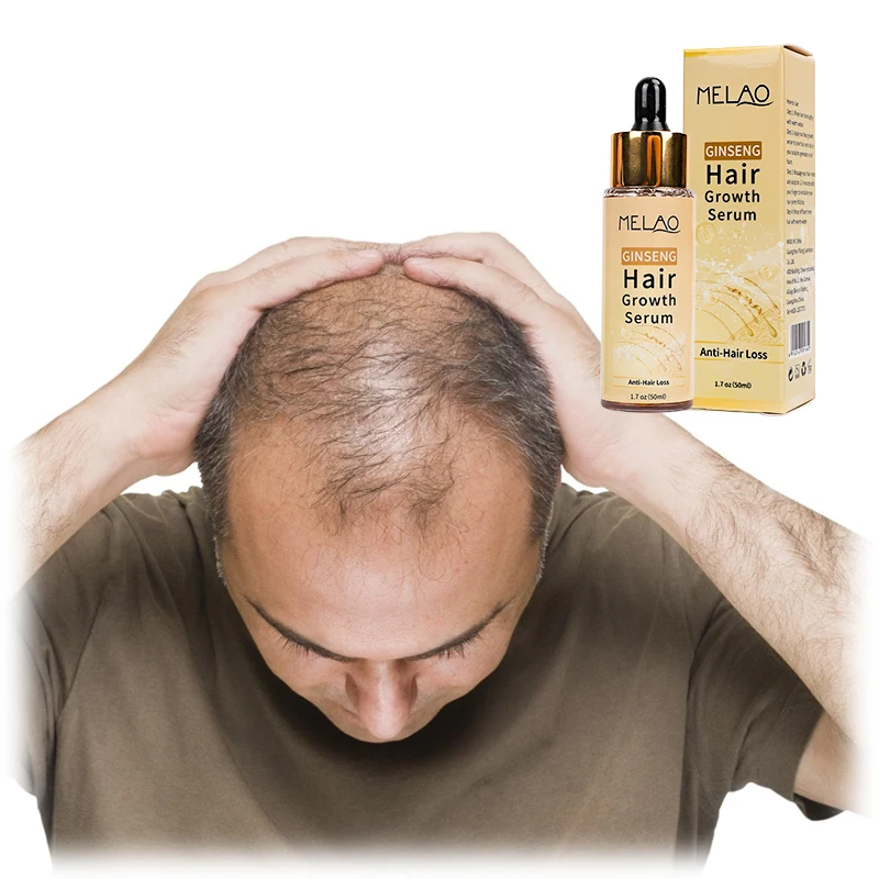 OEM 100% Pure Natural Organic Scalp Essential Oils Anti Hair Loss Product Ginseng Hair Growth Serum