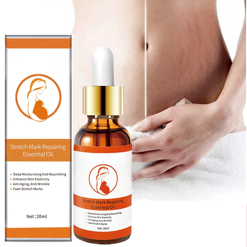 Stretch Marks Remover Essenti al Oil Skin Care Stretch Mark Cream For Stretch Mark Removal Maternity Slackline For Pregnant Oils
