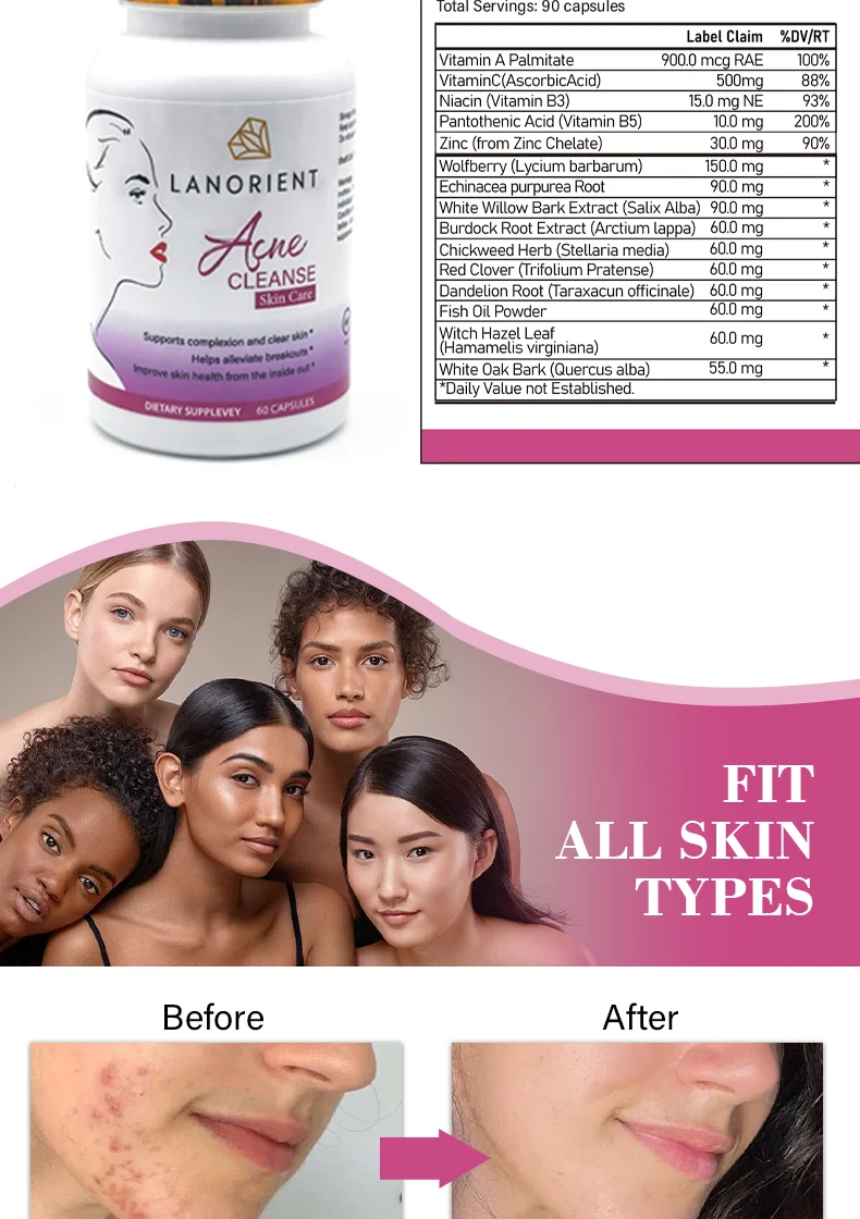 TEEN ACNE Vitamin Supplement Natural Immune Antioxidant Anti-aging Pigmentation Skin Whitening Capsules