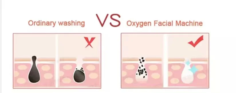 customizable 5th generation spray gun h2o2 face oxygen hydrate clean facial machine