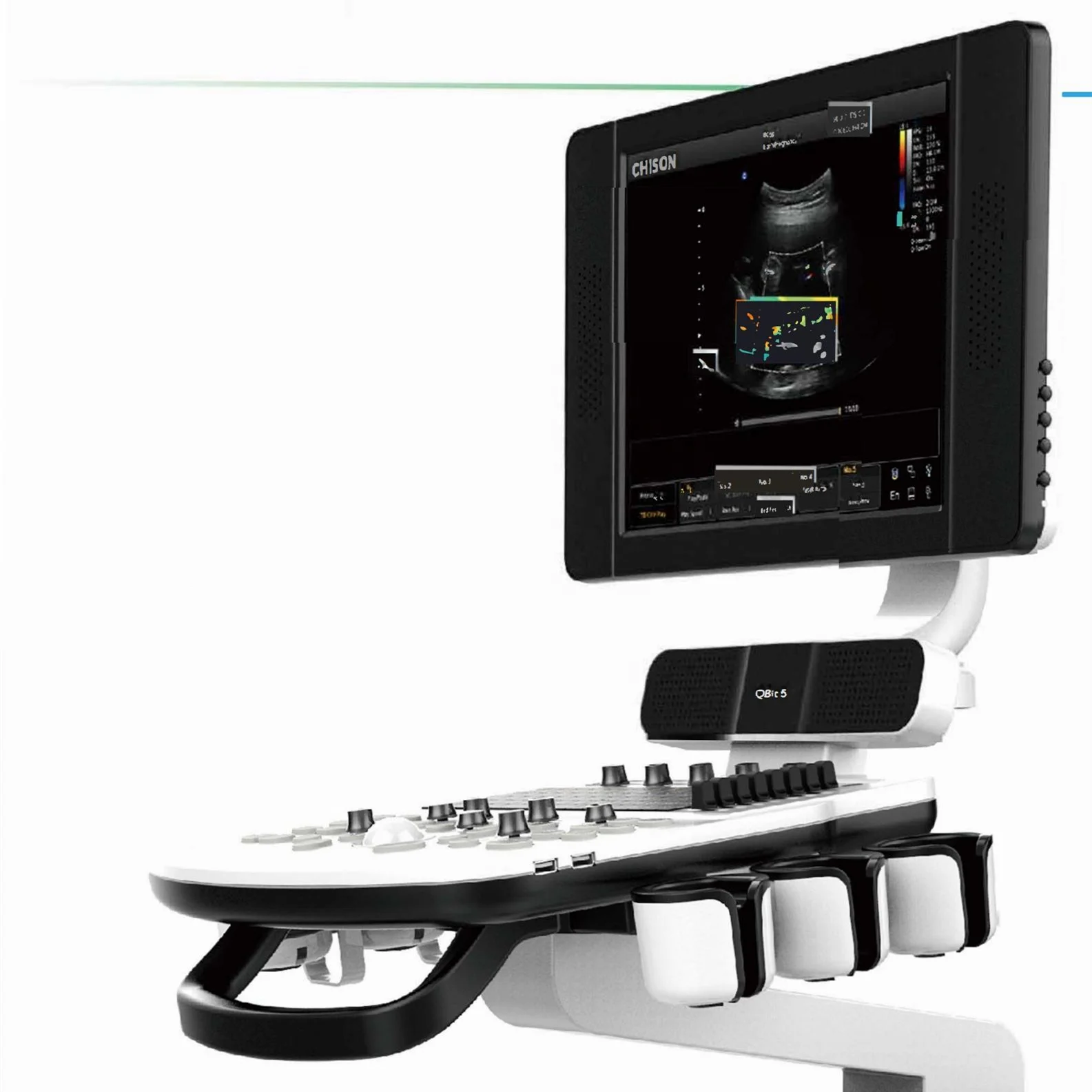  CHISON ультразвук Q Bit 5 цветов Doppler система HD 3D сканер машина с тележкой
