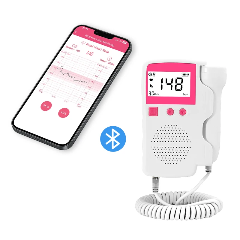 Горячая распродажа Bluetooth детский кардиомонитор с коротким радиусом действия беспроводное подключение 3 МГц в режиме реального времени медицинский фетальный допплер приложением