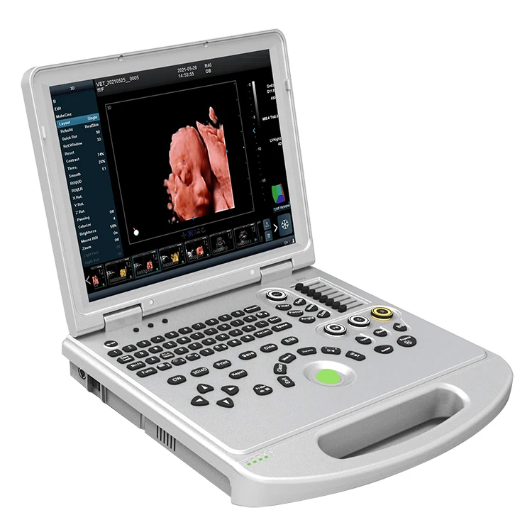 4D 5D Medical ultrasound instruments laptop for clinic hospital portable color doppler ultrasonic ecografo portatil