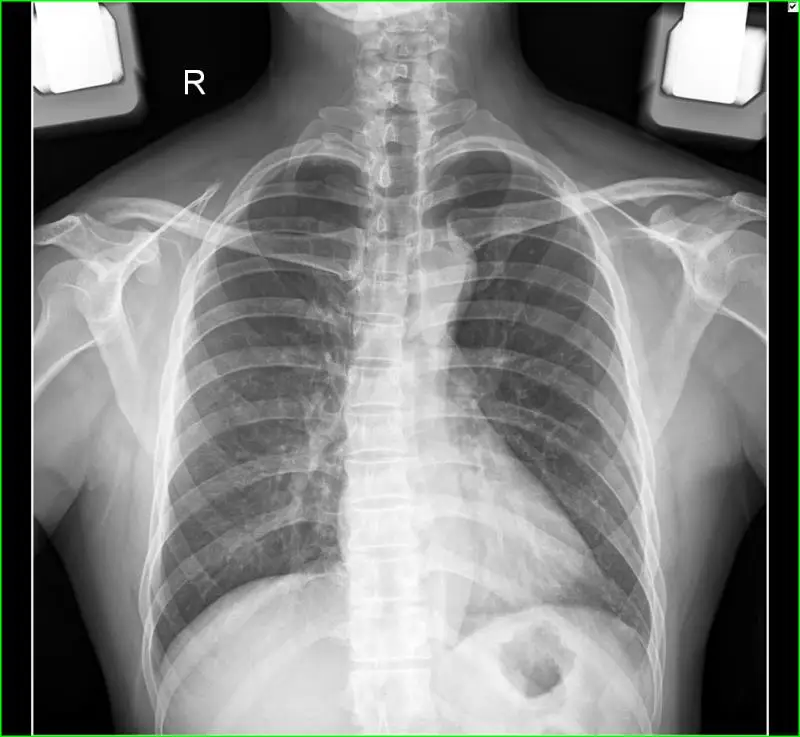 2024 Multiple Languages Touch Screen 5KW High Frequency Portable Digital X-ray Machine 5kw for human use