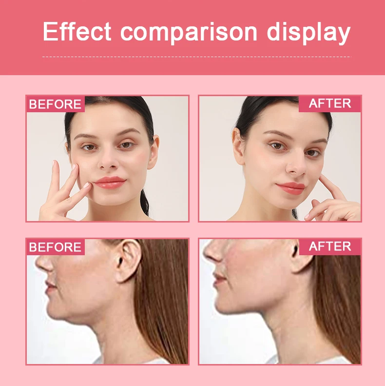 Hot sale Beauty Care Products age defying High Efficiency Slim Shape band v line face lifting Mask