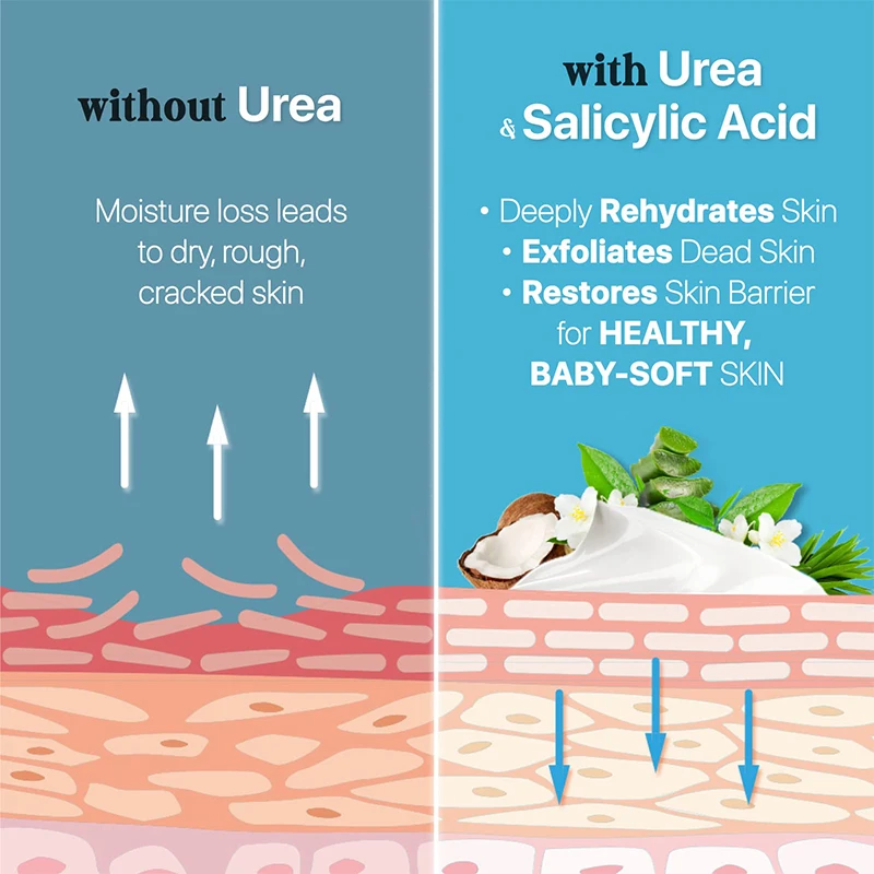 Kangrong Private Label Skin Care Foot Care Organic Moisturizing Callus Remover Hand Cream Foot Cream Salicylic Acid Urea Cream