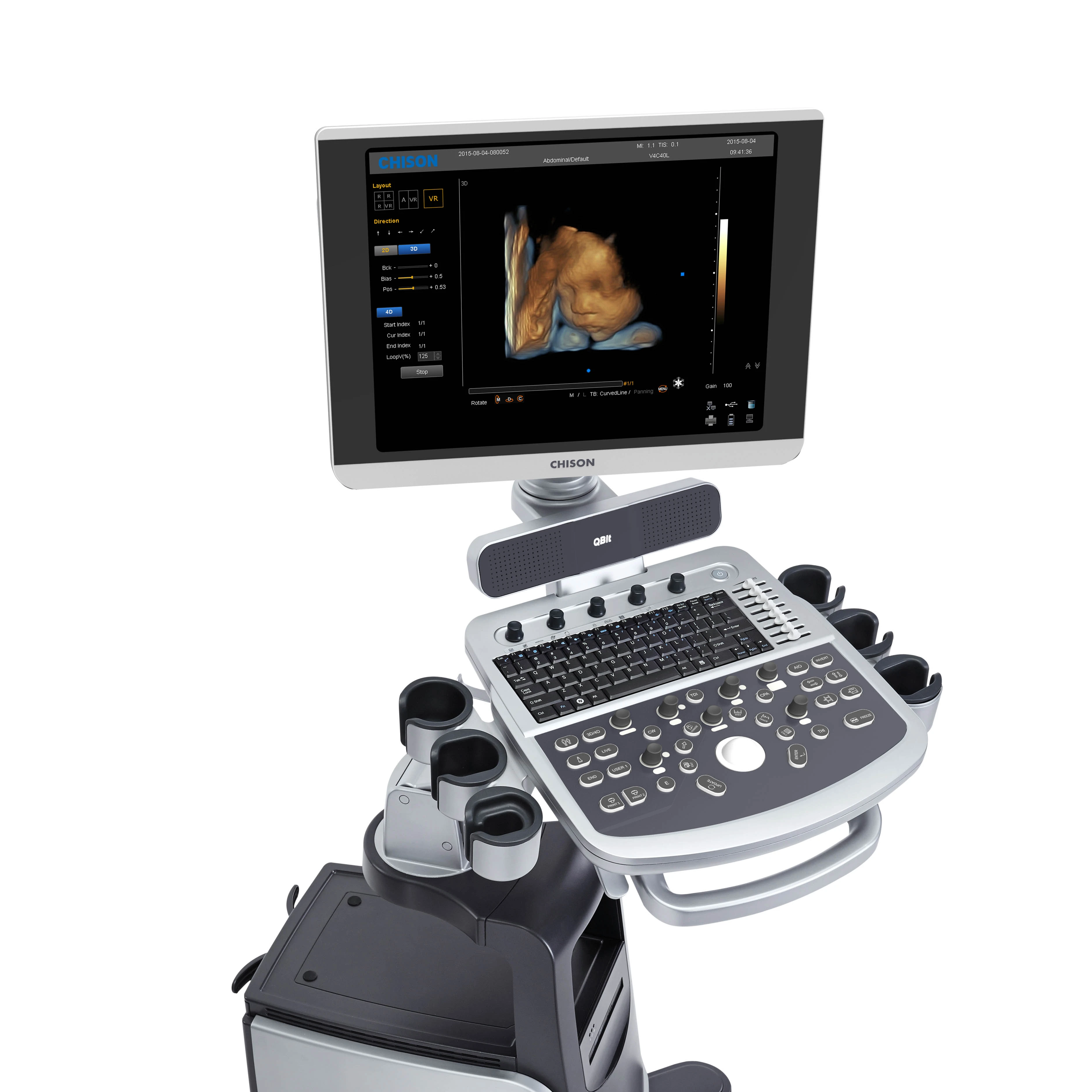 Chison Qbit 9 4d Color Doppler USG Experience the Ultra-Mobility