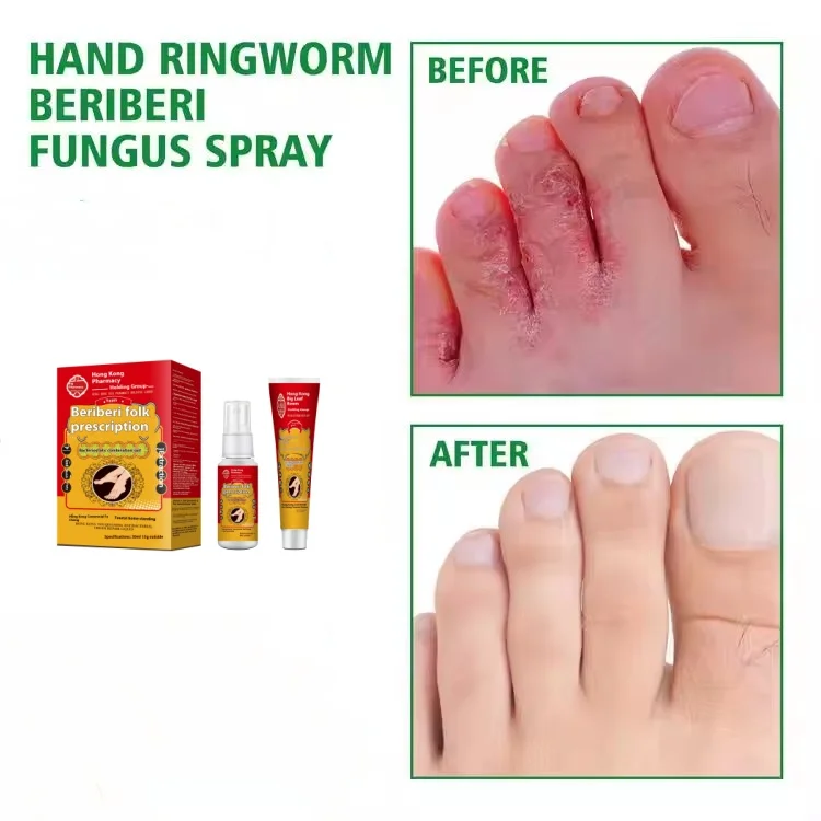 foot care products medicine gentle formula antifungal spray hand ringworm beriberi fungus spray