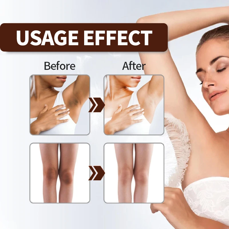 SERSANLOVE To Remove Pimples And Skin Glow Dark Spots Corrector Remover Whitening Face Cream Correcting In Chinese 20G