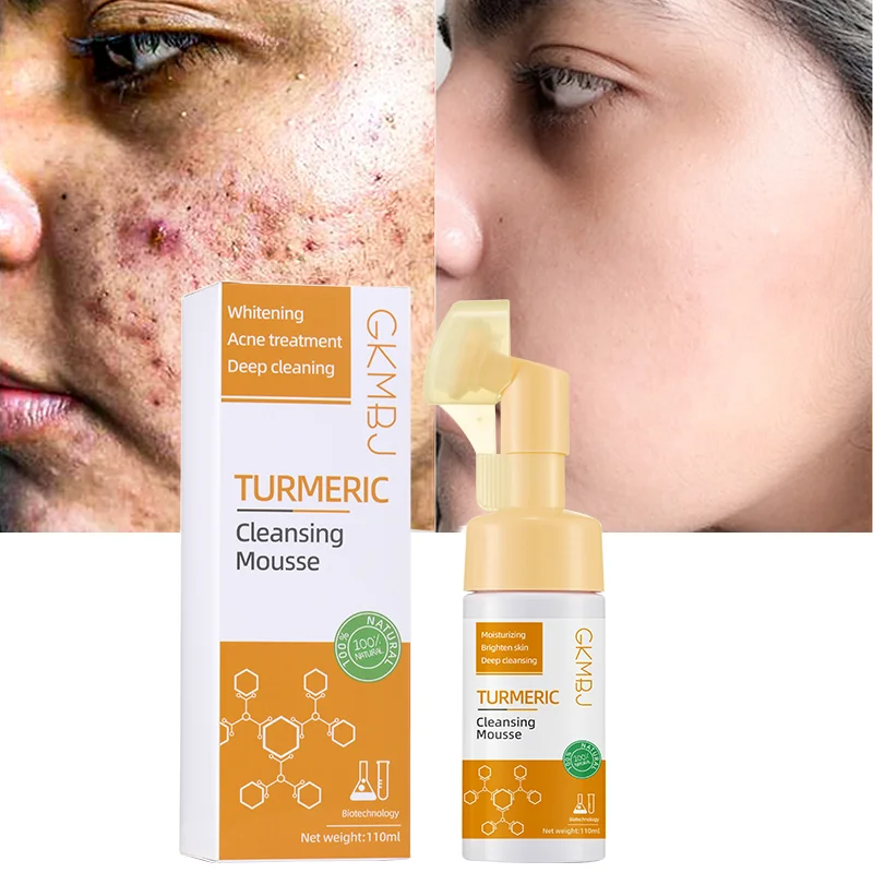 eco-friendly microbial ferment skin care,natural dark spot removal,acne pimple face wash kojic acid turmeric facial gel cleanser