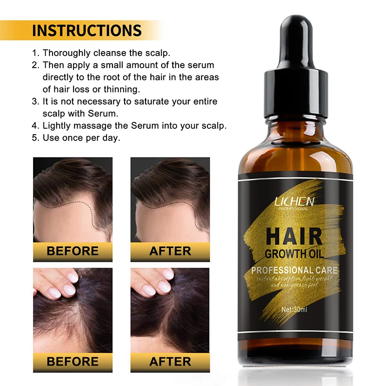 Best bulk extra strength scented all natural herbal hair growth oil alopecia castor oil for hair growth