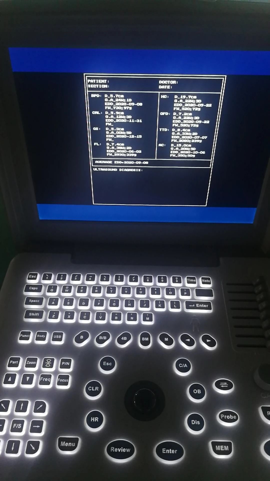 KBW-300 Laptop B&W Ultrasonic diagnostic portable B ultrasound scanner