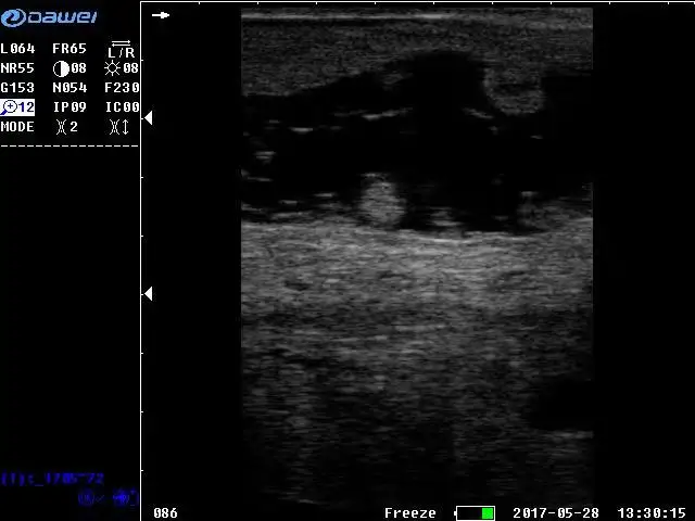 Dawei Portable Vet Ultrasound Rectal Linear Probe Cattle Pregnancy Scanner For Sale