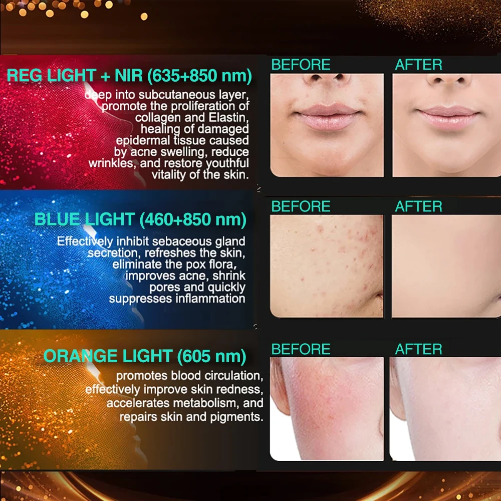 Lightweight design Silicone Led Facial Face Mask infrared red light therapy beauty face neck Soothing Nourishing Photon Mask