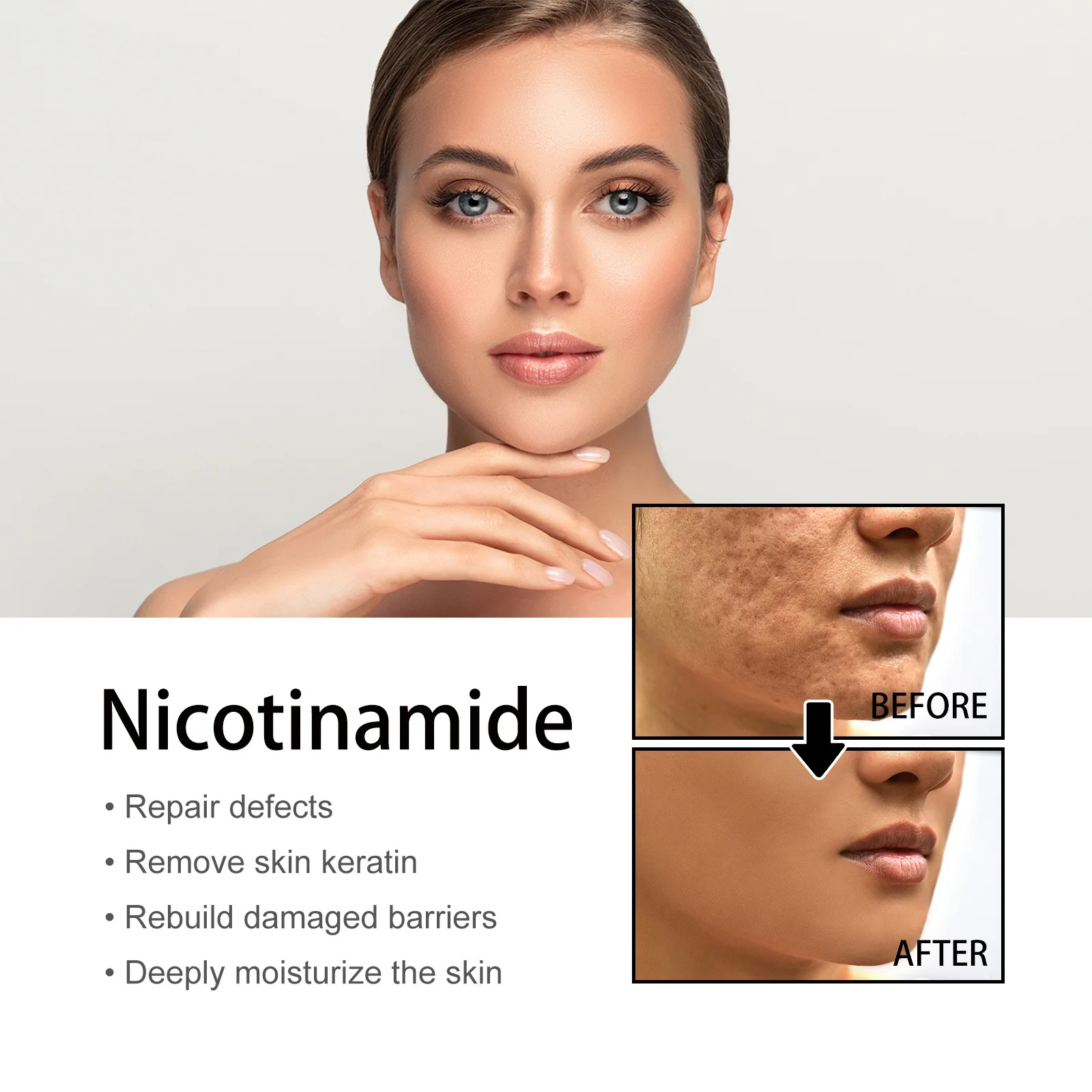 Wholesale Moisturizing&Whitening Skin  Acne and Pore Shrinking Nicotinamide Serum