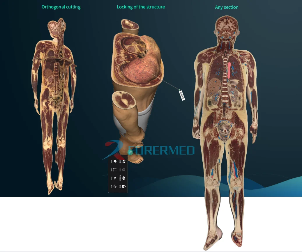 Digital human Virtual Anatomage Table Teach Autopsy Table Touch Screen 87.8 inches 3D anatomy System