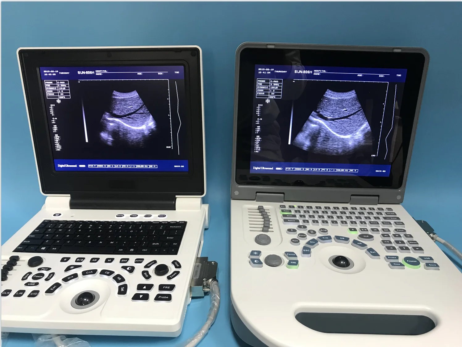 CE medical laptop ultrasound machine professional JM-806G vascular ultrasound China best manufacturer