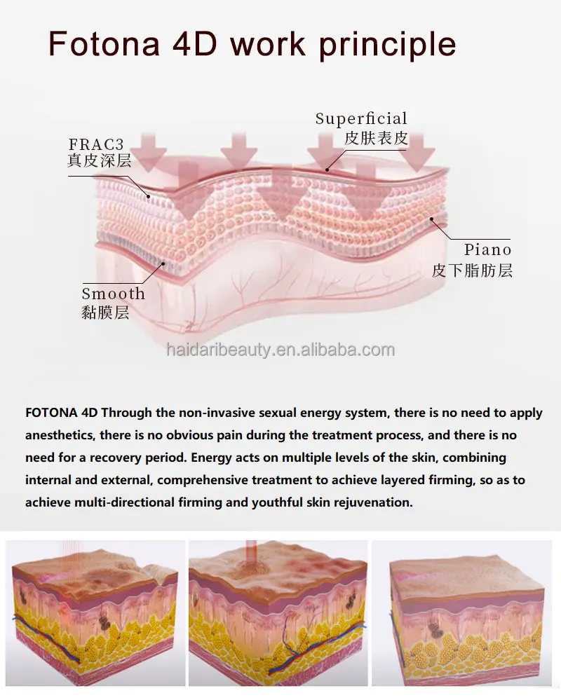 erbium yag laser prowork_01