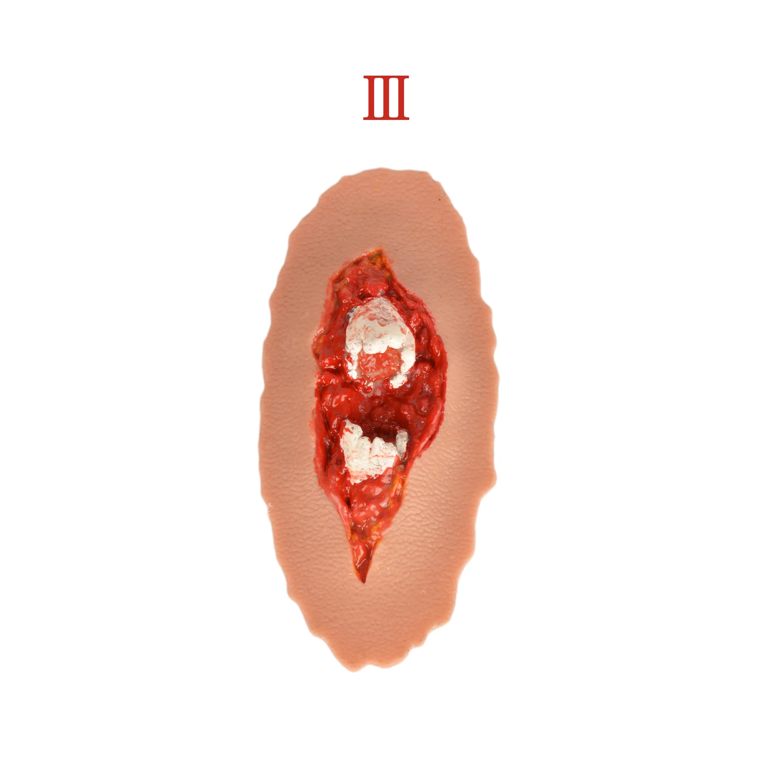 wearable open fracture trauma model for TCCC course EMT course first aid training Pre-hospital emergency care
