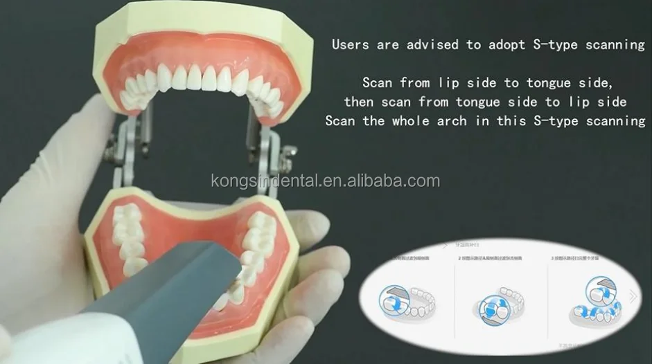 Cameo 3D Digital Dentistry Intraoral Dental Scanner