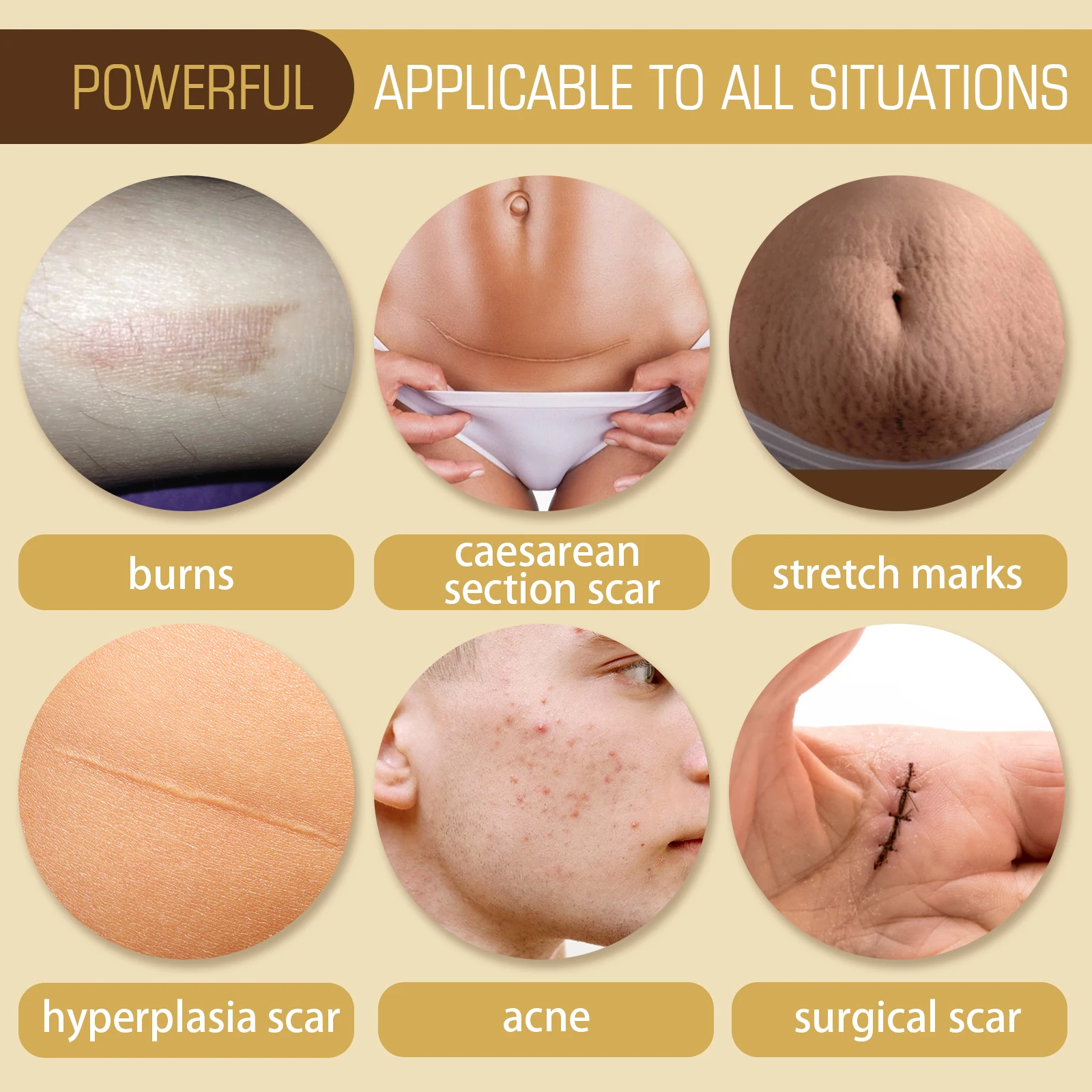 Hot Selling Natural organic fade Caesarean scar surgery scar to burn marks repair and smooth skin scar essential oil