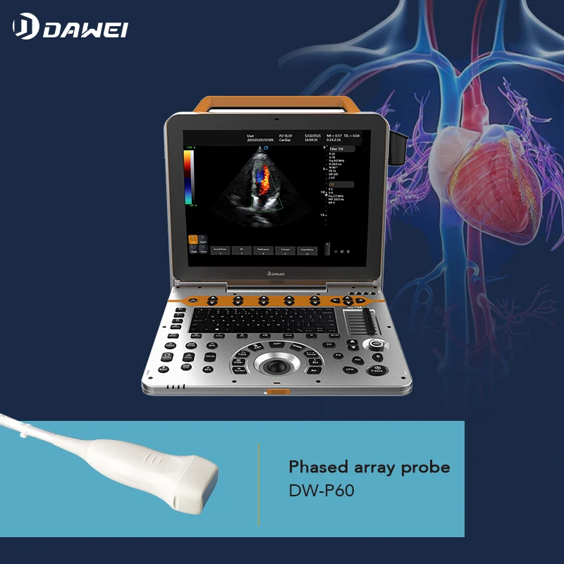 DAWEI P60 4D Portable Color Doppler Human Ultrasound Gynecology Cardiovascular Echo Machine Sale scanner with CE&ISO certificate