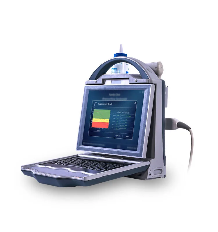 Bone Density Scanner Ultrasonic Bone Density Test Machine for Radius and Tibia Ultrasound Bone Densitometer ultrasound machine