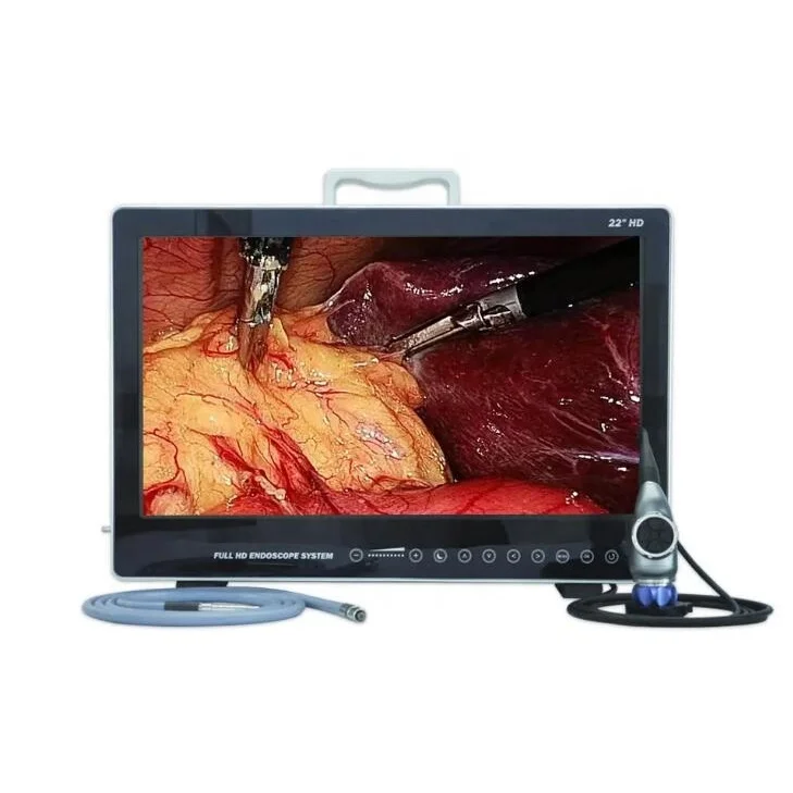 Hot selling IKEDA Portable Medical Endoscopy Camera System with In-Built Recorder