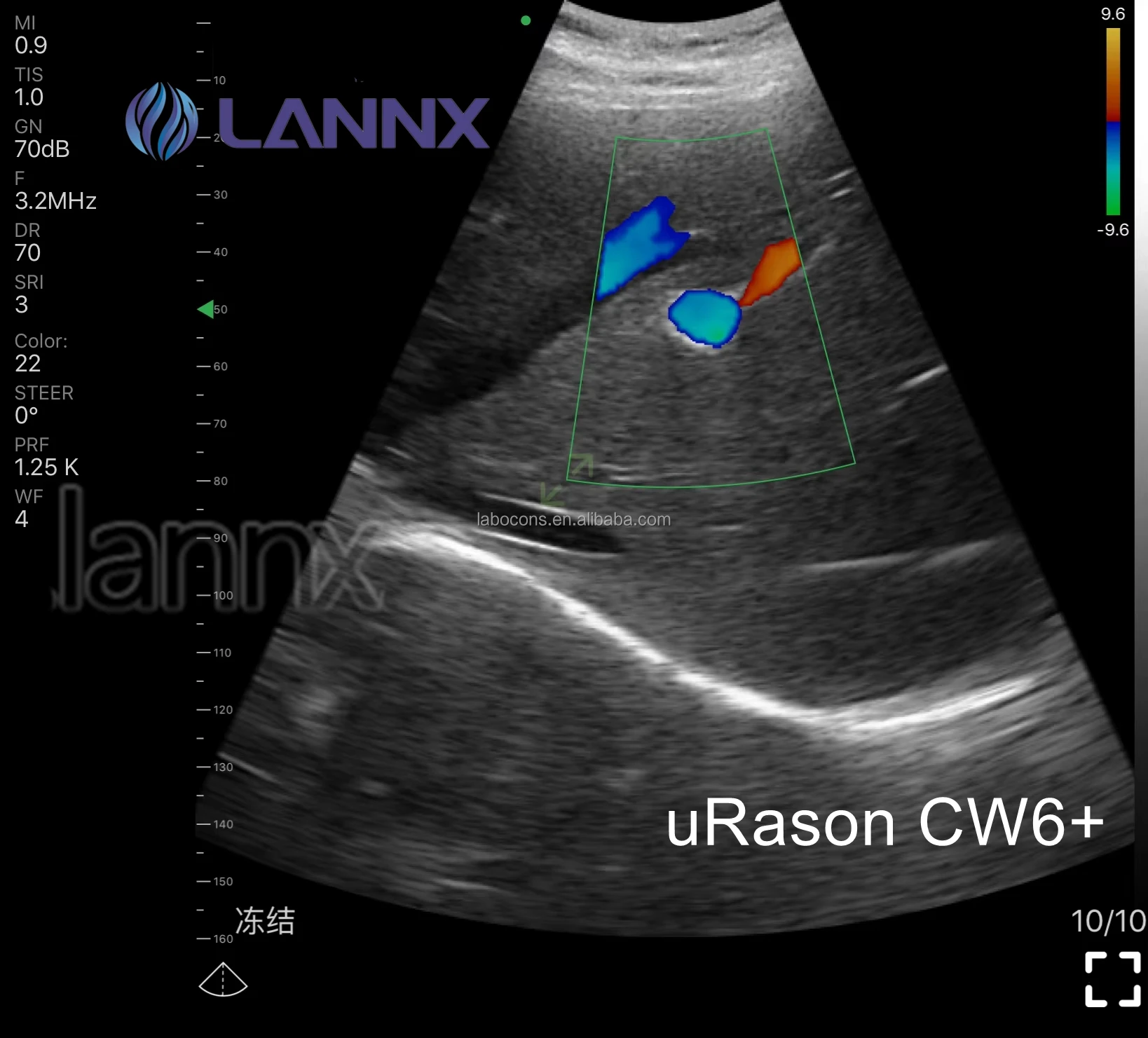 LANNX uRason CW6+ New 128 elements 3 in 1 USG Wireless Ultrasound Probe Thyroid Pregnancy Cardiac Color Doppler Probe Ultrasound