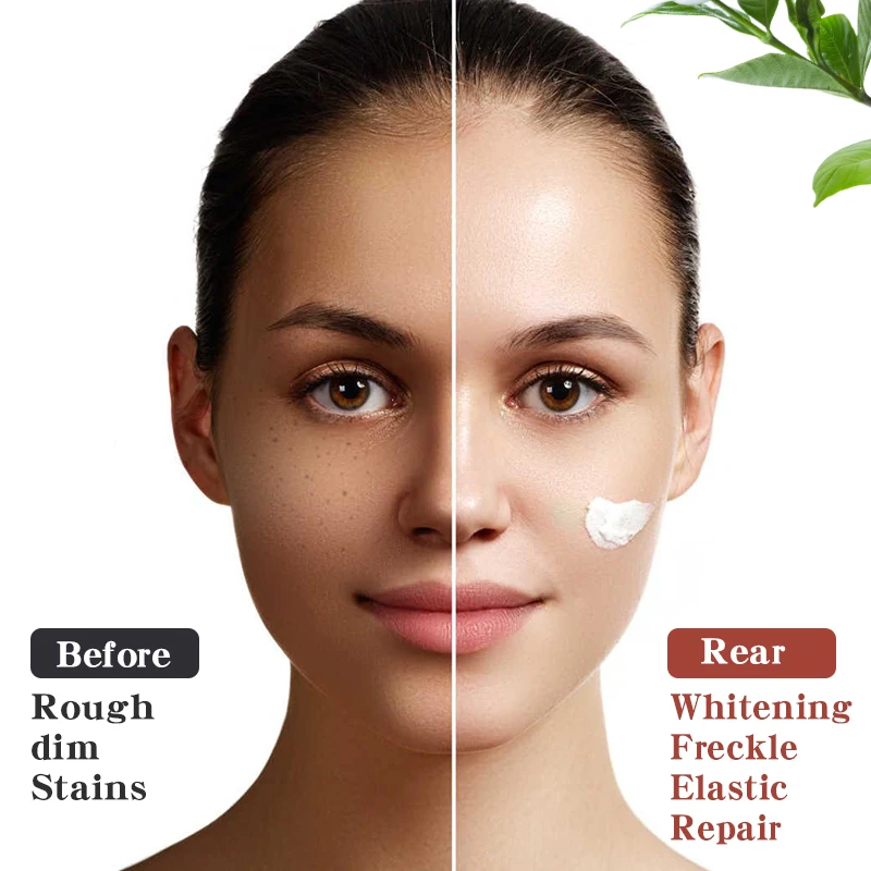 New Face Cream & Lotion Dark Spot Removal Crema Blanqueadora Whiting Cream Vit B Vitamin C Whitening Face Cremas