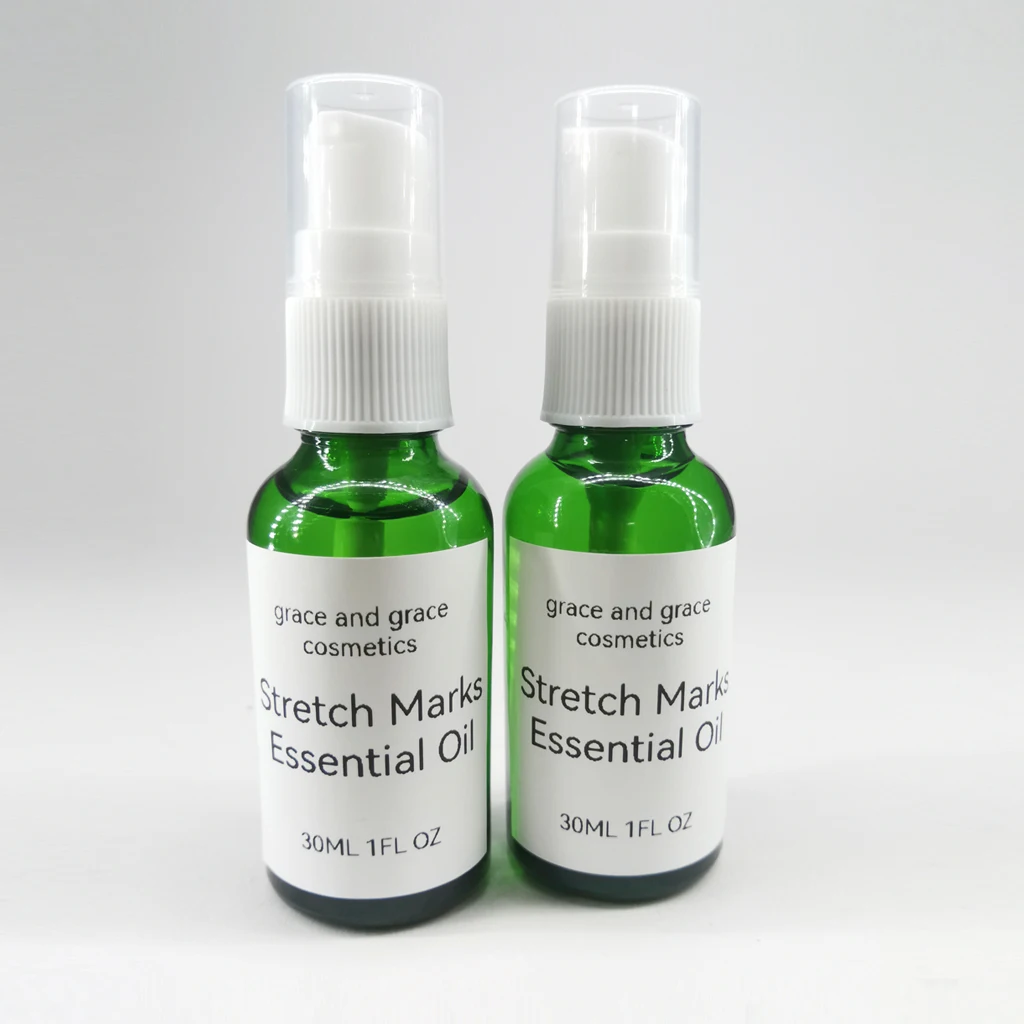OEM and private label service 30 ml Stretch Marks Essential Oil