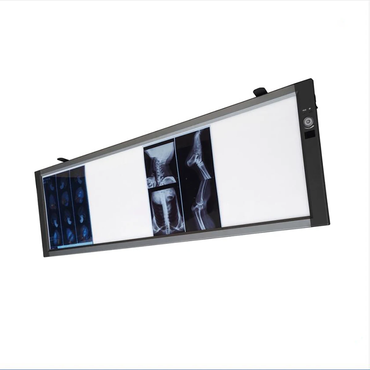 
China Quadruple Panel Medical LED X-ray Film Viewer X-ray Viewing Light MSLZG4C 