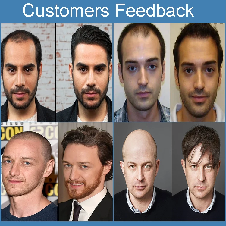  Оптовая продажа Заводская система замены человеческих волос Remy мужской парик из тонкой кожи в наличии