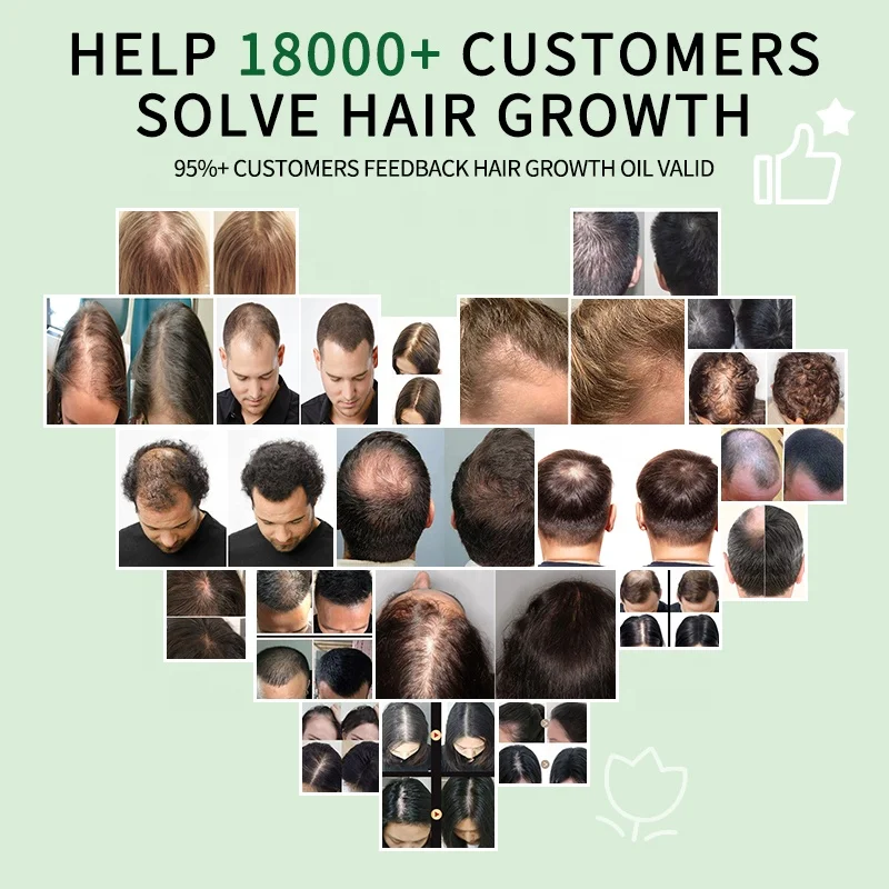 Rosemary Scalp Oil Organic Natural 7 Days Hair Tonic Free Hair Growth Oil for Alopecia Gallon Big Bottle Serum