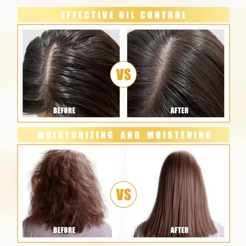 100% Pure Natural Custom Private Label Fast Hair Growth Ginger Anti-Dandruff Organic Tea Tree Oil Shampoo And Conditioner Set