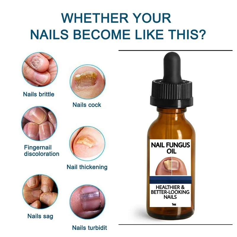 Customized Nail Fungus Oil Beautiful Healthy Nail Care Nail Fungal Treatment Serum for Hand Foot Removal Repair Gel