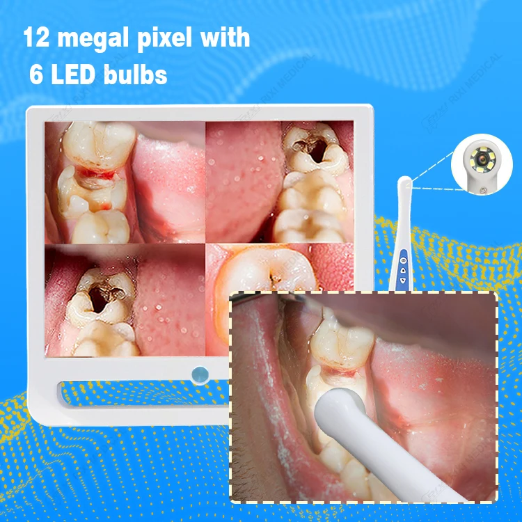 Intra Oral Camera With Monitor Surgery 17 Inches Camera Medical Oral Camera 12 megapixel dental endoscope