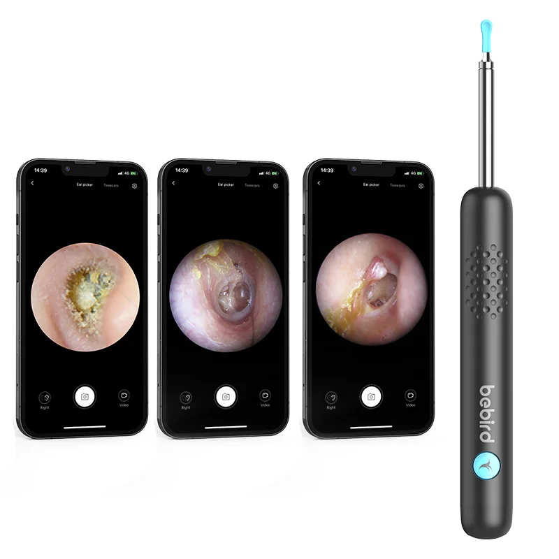 New designed bebird R1 ear otoscope ear picking tools diagnostic ear cleaner mini endoscope camera