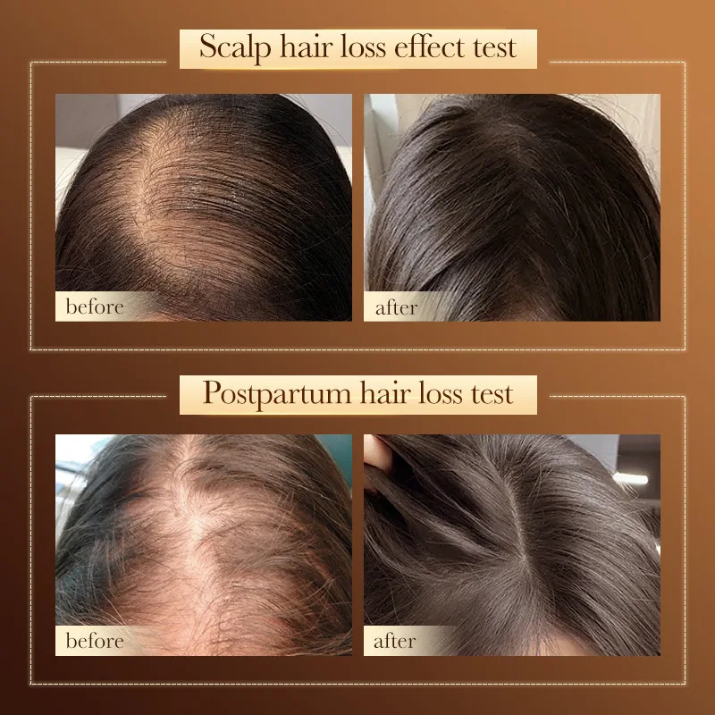 Best Seller Organic Natural Fast Hair Growth Shampoo Argan Oil Private Label and Conditioner