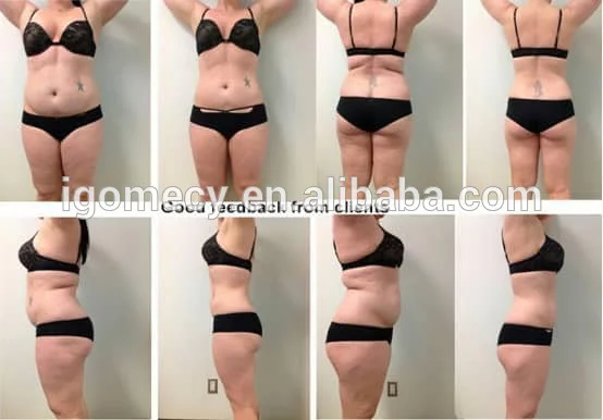 6D-Lipo-Laser-Slimming-Machine-With-16-Pads-635nm-650nm-780nm-810nm-940nm-980nm-Diode-laser-light-therapy-machine