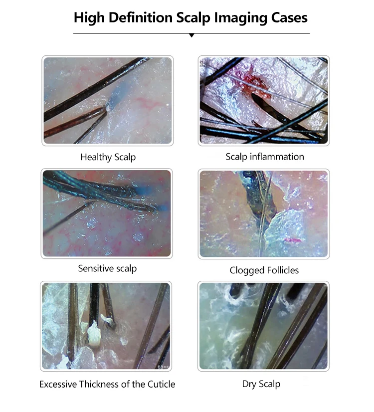 High Quality 200x Magnification 50x Triple Spectrum Desktop Scalp Test Instrument Photo Framing Convenient Detection