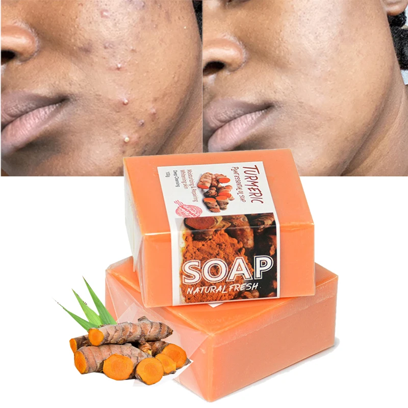 Private Label Organic Vegan Whitening Glowing Face Soap Anti Acne Tumeric Turmeric Soap Bar For Skin Whitening