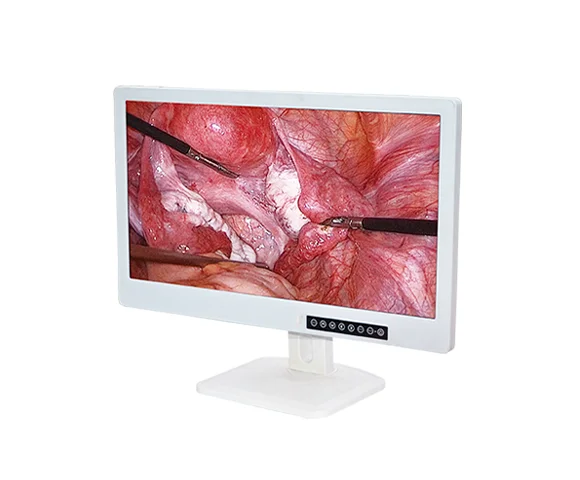 Professional medical grade monitor 24 inch medical monitor