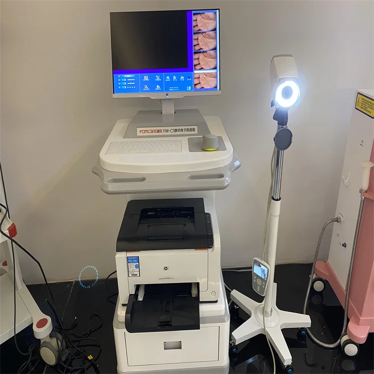 High quality C6HD handheld colposcope medical digital imaging colposcope can be customized